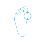 KBF Foot and Ankle Bunions